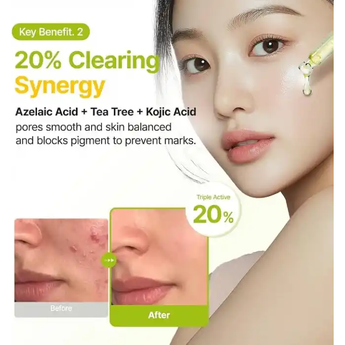 Purito Azelaic Acid 10% Kojic Acid Tea Tree Serum | Akne Karşıtı Leke Görünümü Dengeleyici Serum 30 ml