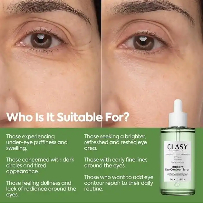CLASYCARE Radiant Göz Çevresi Serumu – Kafein Göz Serumu – Hyaluronik Asit ve C Vitamini ile Göz Altı Morlukları, Şişlik ve İnce Çizgilere Karşı Etkili – Tüm Cilt Tipleri İçin, 50 ml