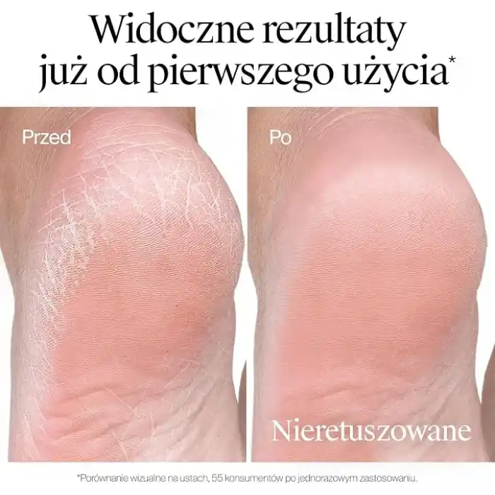 Neutrogena Çatlak Topuklar için Ayak Bakım Kremi