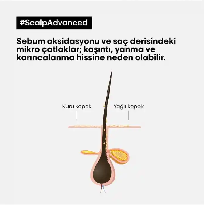 LOréal Professionnel Paris Serie Expert Scalp Advanced Kepek Karşıtı Profesyonel Şampuan 500ml