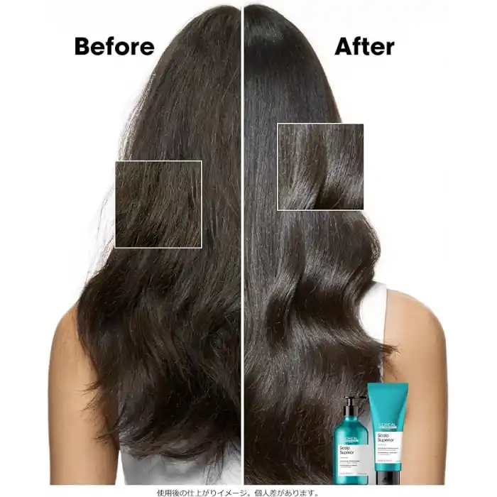 LOréal Professionnel Paris Serie Expert Scalp Advanced Hassas Saç Derisi Için Profesyonel Şampuan 500ml