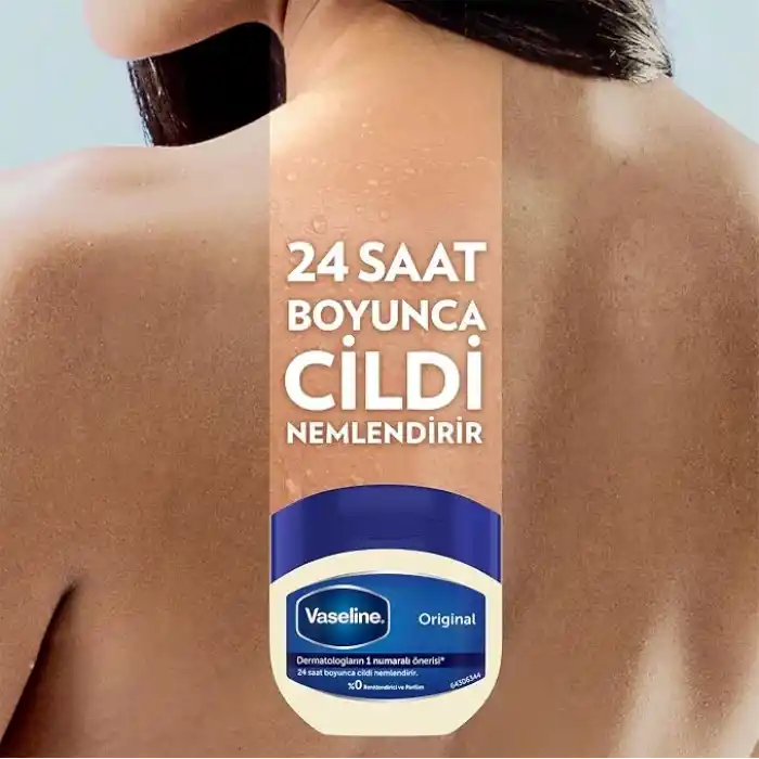 Vaseline Nemlendirici Jel Original 100 ml