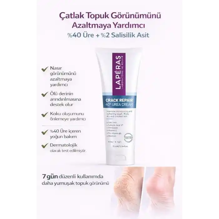 Ayak ve Topuk Çatlak Bakım Kremi%40 Üre ve%2 Salisilik Asit Nasır, Sert ve Ölü Deriler, Ayak Kokusu Karşıtı Nemlendirici Krem 75ml