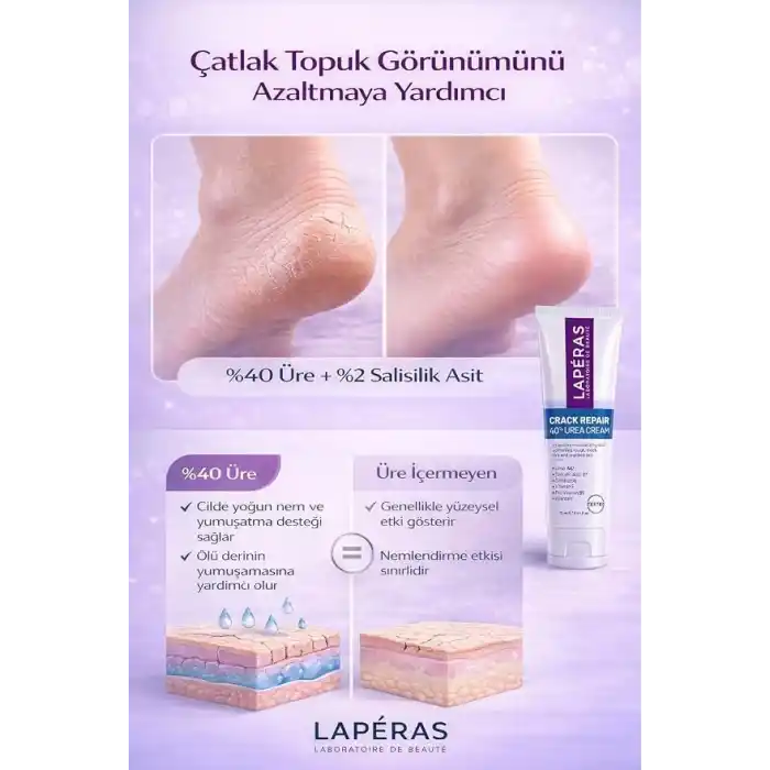 Ayak ve Topuk Çatlak Bakım Kremi%40 Üre ve%2 Salisilik Asit Nasır, Sert ve Ölü Deriler, Ayak Kokusu Karşıtı Nemlendirici Krem 75ml