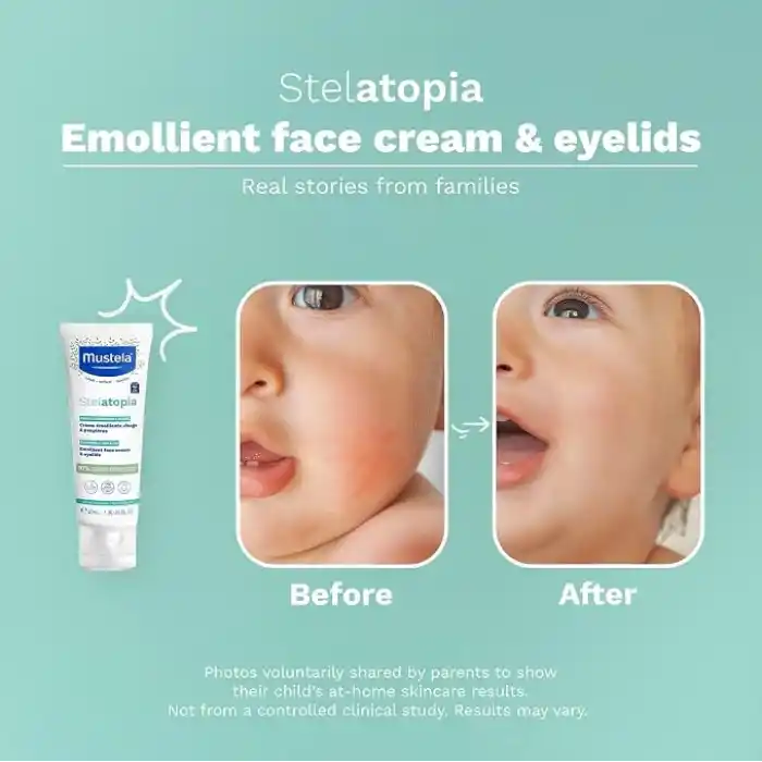 Mustela Stelatopia Emollient Yüz Kremi 40 ml