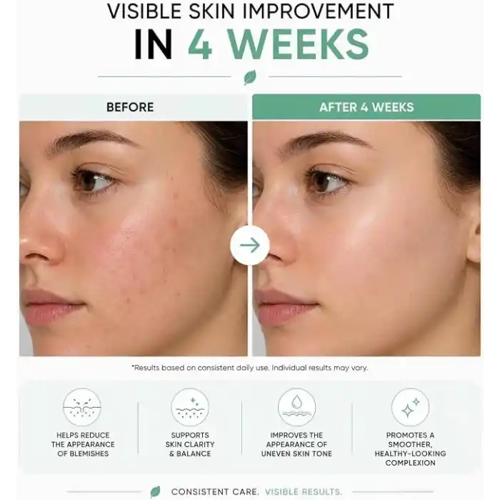 MIA KLINIKA Azelaik Asit Serumu Niacinamide & Çinko ile 30ml