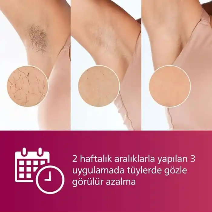 Philips Lumea IPL Tüy Alma Cihazı, Çantalı, Yüz Temizleme Cihazı Hediyeli, Yüz/Vücut/Hassas Bölge Kullanımı, Cilt Tonu Sensörü ile Güvenli Epilasyon BRI924/00