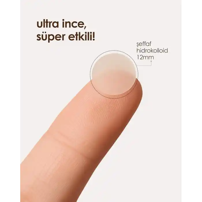 StopEver Clearly Spot Patch, Sivilce Karşıtı Şeffaf Plaster 2li Paket | Ultra İnce, Hidrokolloid + Niacinamide + Salicylic Asit İçerikli Akne Karşıtı Yüz Bandı | 48 adet (2 x 24)