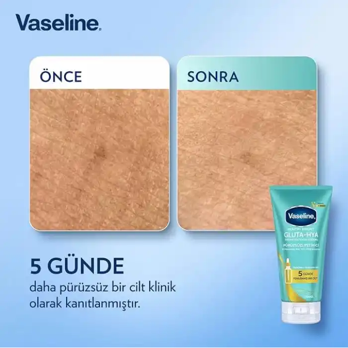 Vaseline Gluta-Hya Serum Etkili Vücut Losyonu, Pürüzsüzleştirici, 170 Mililitre