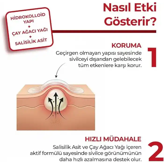 Sivilce Bandı, Aktif-Hızlı Sonuç, 144 Adet, Hidrokolloid Akne Bandı