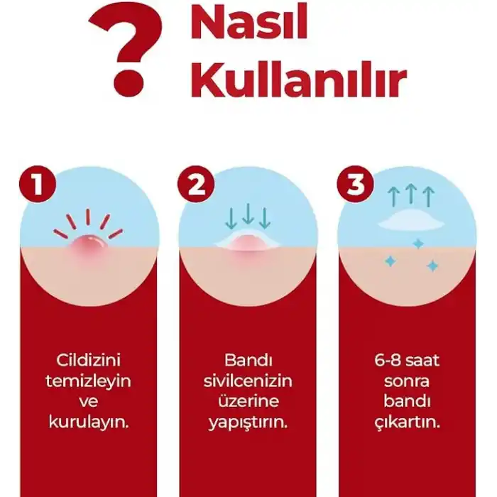 Sivilce Bandı, Aktif-Hızlı Sonuç, 144 Adet, Hidrokolloid Akne Bandı
