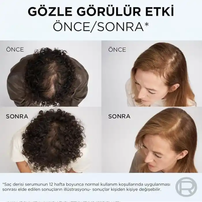 ELSEVE Growth Booster Dökülme Karşıtı Saç Bakım Kremi 150ml