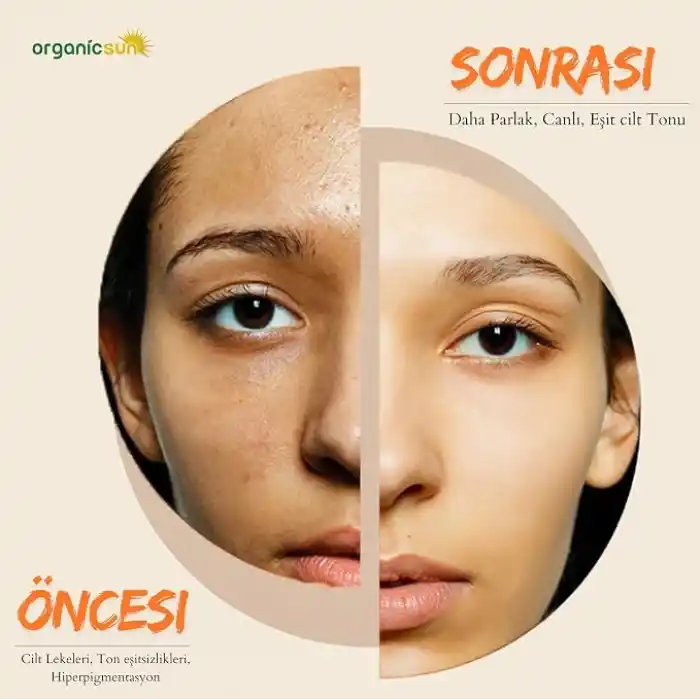 Kojik Asit & Zerdeçal Sabunu 140 Gr 1 Adet Leke ve Sivilce Karşıtı Kojic Acid - Kolajen - AHA BHA - C Vitamini - Hyaluronic Acid - Shea Butter Yağı İçerikli Aydınlatıcı Sabun