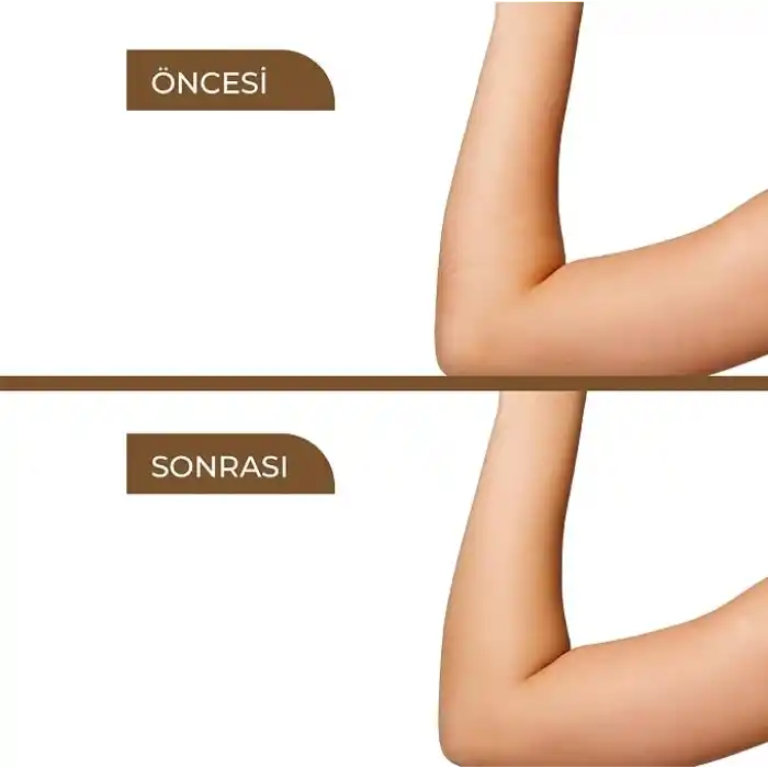 Karınca Yumurtası Yağı Tüy Azaltıcı Bakım Serumu, Tüy Dökücü, Batık Önleyici, Hassas Ciltler için, Yüz ve Vücut