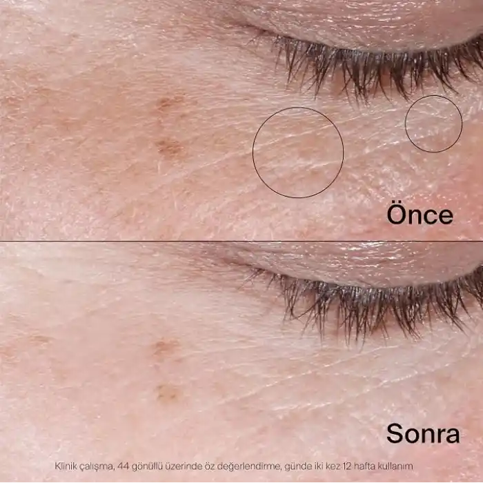 Neutrogena Collagen Bank Canlandırıcı Jel Göz Kremi 15 g