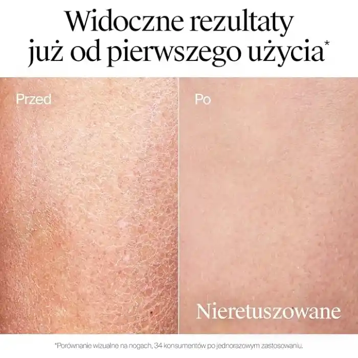 Neutrogena Yoğun Nemlendirici Parfümlü Vücut Losyonu (400 ml)— Kuru ciltler için vücut nemlendiricisi — Pro-Seramid ve Gliserin Teknolojisi ile geliştirilmiş formül