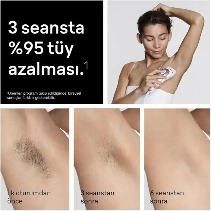 Braun IPL Skin i·expert, Evde Lazerle Tüy Alma, App ile, Mini Yüz Tüy Alma Cihazı, 4 Başlık, PL7432