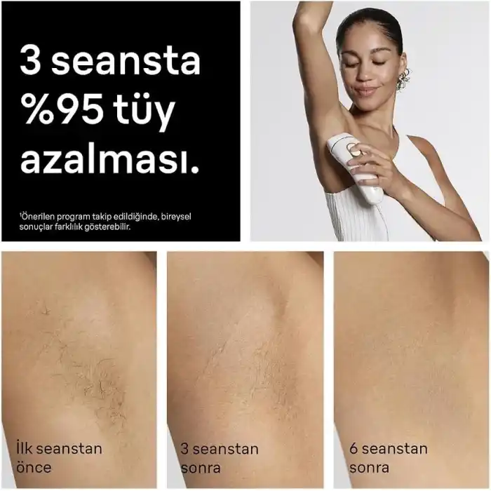 Braun IPL Silk·expert Pro 5, Evde Lazerle Tüy Alma, Çanta, Gillette Venus, 3 Başlık, PL5311