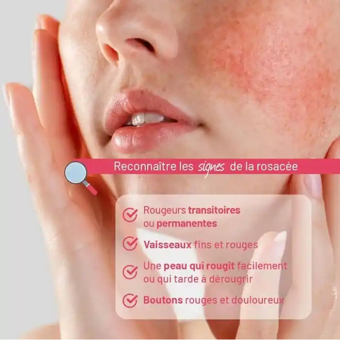 IsisPharma Metroruboril Az 30 Ml