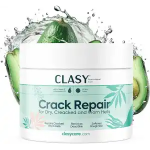 CLASYCARE Topuk Çatlağı Kremi – Kuru ve Çatlamış Topuklar için – E Vitamini ve Avokado Yağlı Topuk Kremi – Nasır, Sert ve Ölü Deriler için Nemlendirici Ayak Bakım Kremi – 100 ml