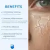Cosmed Yatıştırıcı Onarıcı Bariyer Kremi 4C Cica Cream 40 gr