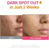Purito TXA 6 Niacinamide 10 Retinal Serum | Leke Karşıtı Aydınlatıcı Yaşlanma Karşıtı Serum 30 ml