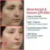 CLASYCARE Akne Kremi Yüz İçin – Sivilce ve Akne Karşıtı Leke Kremi – Salisilik Asit & Niasinamid ile Leke Giderici – Genç ve Yetişkin Cilt Bakımı, 40 ml