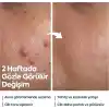 CLASYCARE Akne Kremi Yüz İçin – Sivilce ve Akne Karşıtı Leke Kremi – Salisilik Asit & Niasinamid ile Leke Giderici – Genç ve Yetişkin Cilt Bakımı, 40 ml