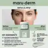 Maruderm Glikolik Asit%5 Gözenek Arındırıcı ve Cilt Tonu Eşitleyici Kil Maskesi – Vegan, Pürüzsüz ve Nemlendirici Arındırıcı Maske, 100 ML
