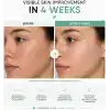 MIA KLINIKA Azelaik Asit Serumu Niacinamide & Çinko ile 30ml