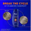 Head & Shoulders Clinical Strength Şampuan 400 ml