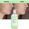 Maruderm Karma ve Yağlı Ciltler için Yüz Yıkama Jeli – Salisilik Asit ile Arındırıcı Günlük Temizleyici, Bitki Proteinleriyle, 400 ML