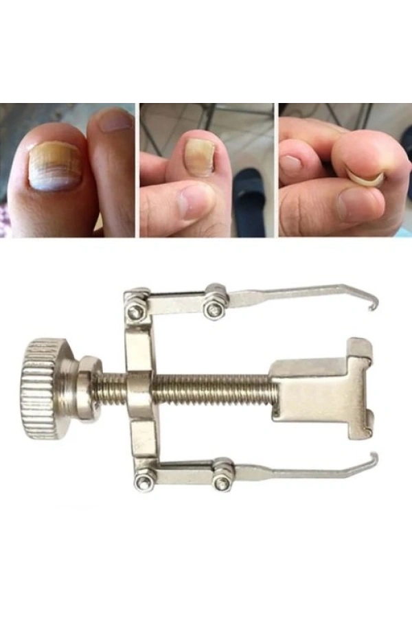 Bidebuvar Batık Tırnak Düzeltme Aleti