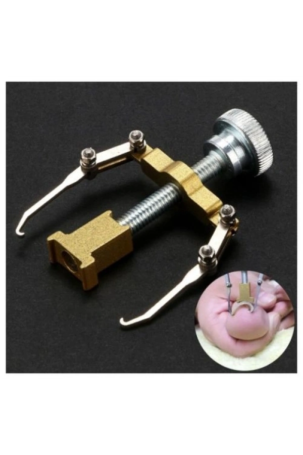 Bidebuvar Batık Tırnak Düzeltme Aleti