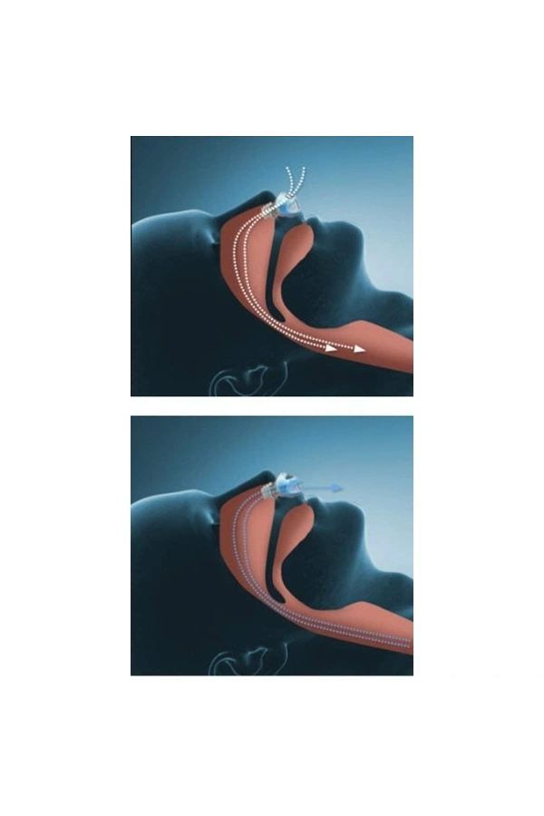 Bidebuvar Horlama Önleyici Rahat Uyku Aparatı