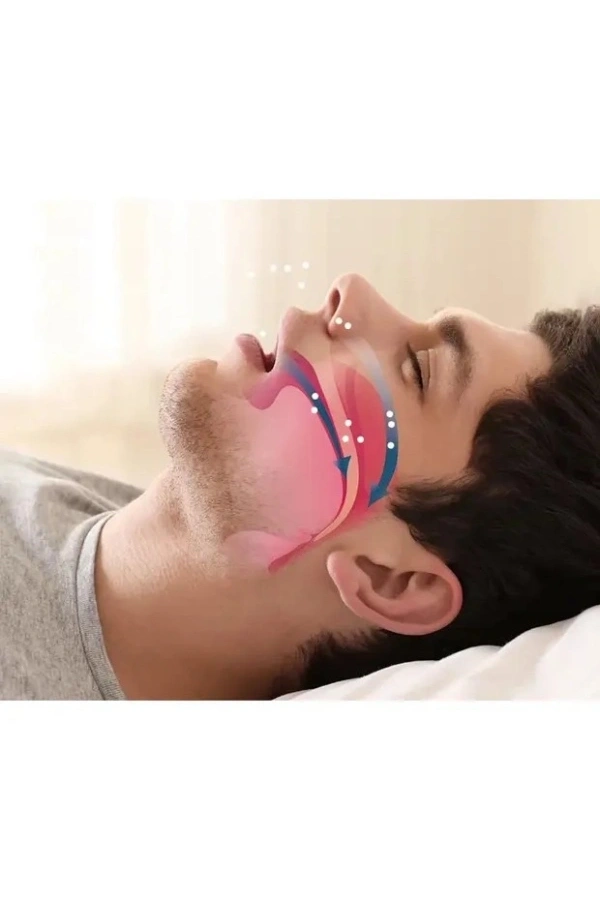 Bidebuvar Horlama Önleyici Rahat Uyku Aparatı