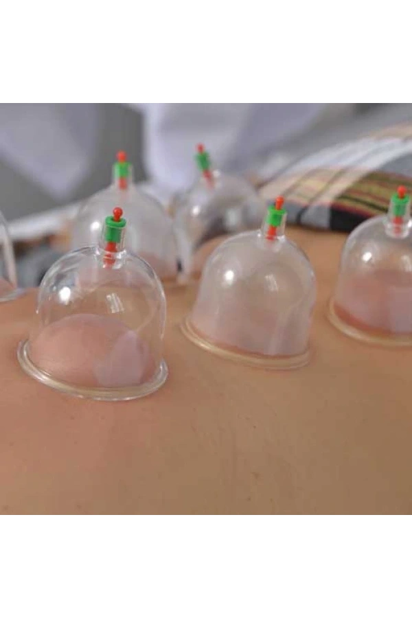 Bidebuvar Kupa Çekme Hacamat Seti 6 Adet