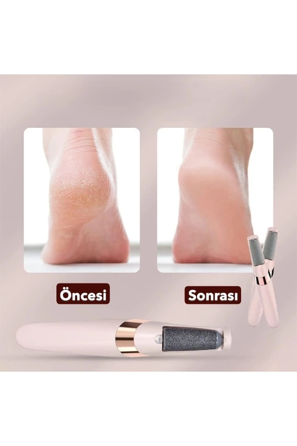 Bidebuvar Şarjlı Ayak Törpüsü - Pedikür ve Ayak Bakım Aleti