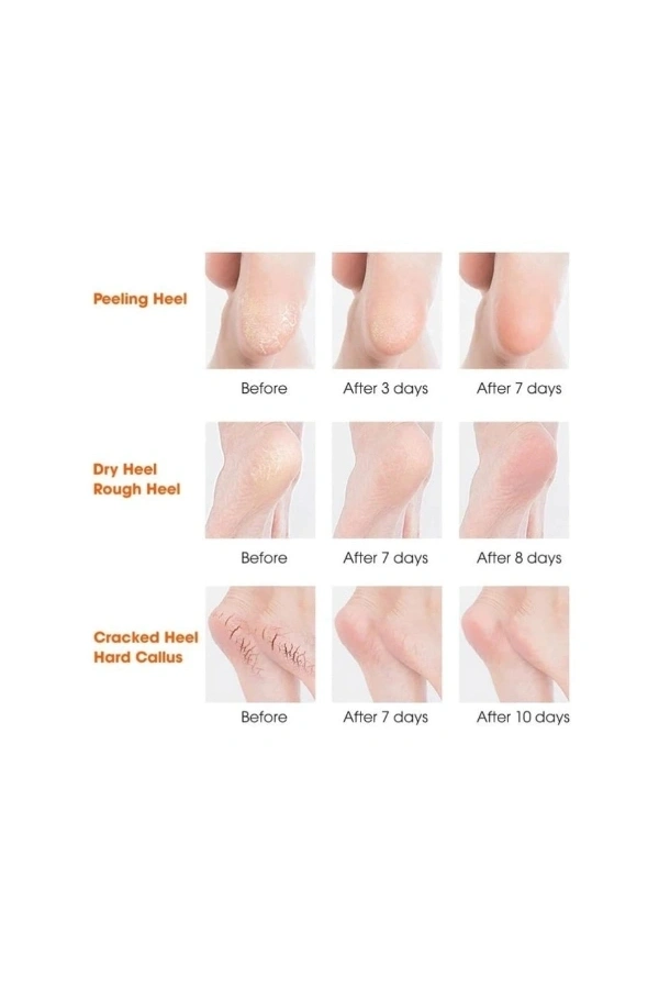 Bidebuvar Silikon Topuk Nemlendirici Çorap