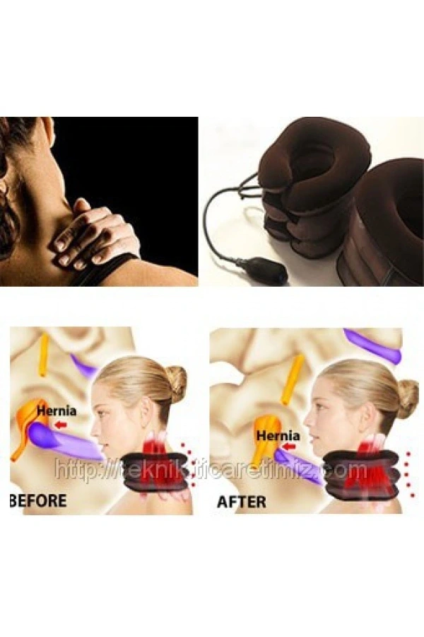 Bidebuvar Şişirilebilir Pompalı Ortopedik Boyun ve Seyahat Yastığı