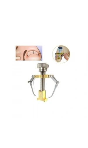 Bidebuvar Batık Tırnak Çıkartıcı Aparat