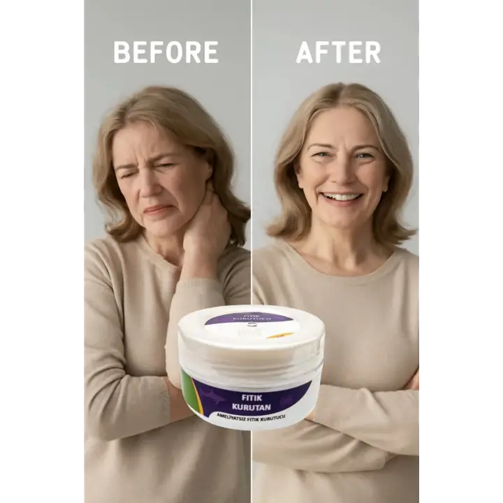 Fıtık Kurutan Krem 50 Ml
