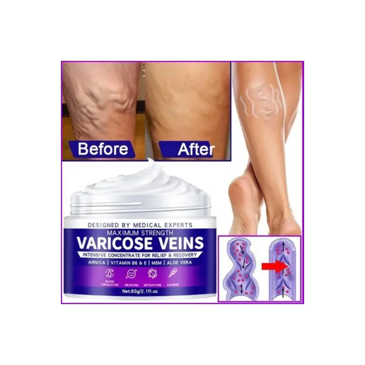 Maximum Strength Varicose Veins Krem 100 ml 1 Adt