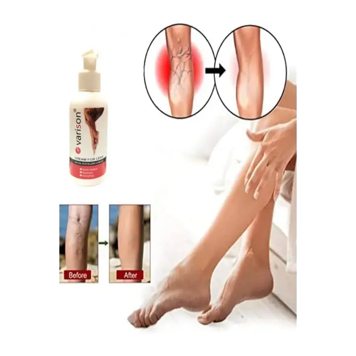 On  Sellülit Bacak Bakım Kremi 120 ml