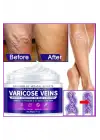 Maximum Strength Varicose Veins Krem 100 ml 1 Adt
