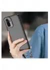 Newface Xiaomi Redmi Note 10 Pro Kılıf Elegant Kapak - Pudra