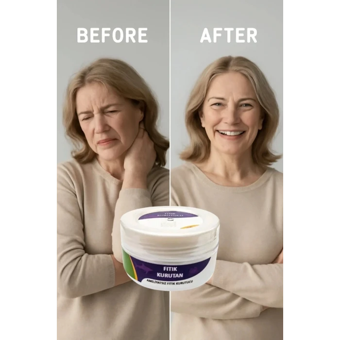 FITIK KURUTAN KREM 50 ML