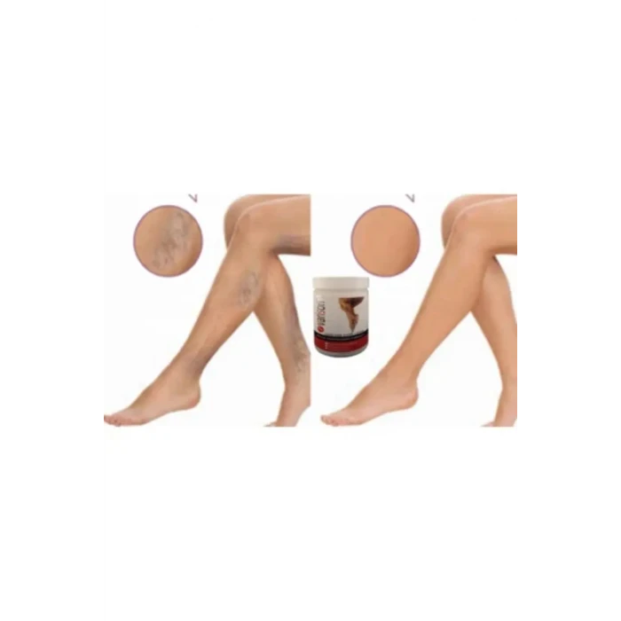 Kremi 200ML / Varison Varicose Veins Cream 200ML X 2 ADET