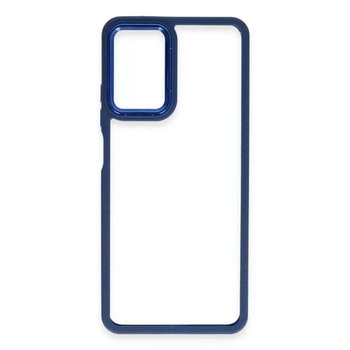 Newface Realme 10 Pro 5G Kılıf Dora Kapak - Mavi