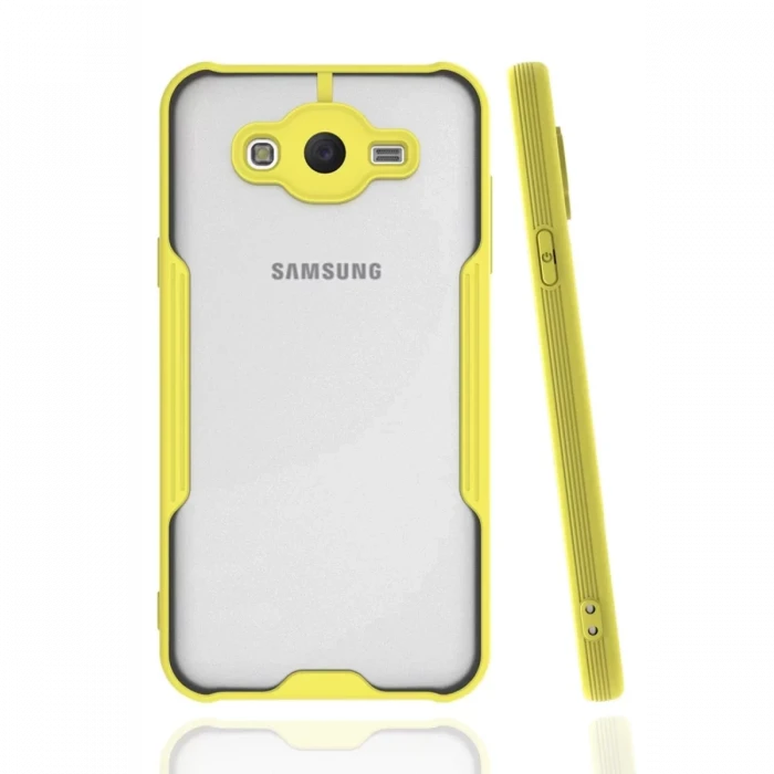 Newface Samsung Galaxy J7 Kılıf Platin Silikon - Sarı